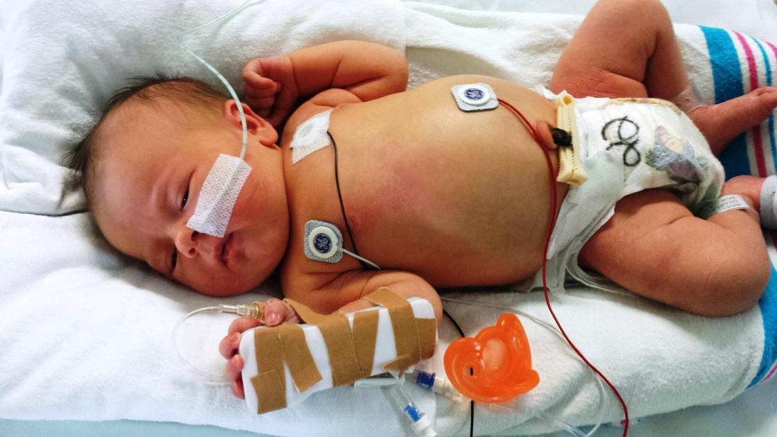 Fotografía cedida hoy por Jeffrey Group donde aparece un bebé en cuidados. Los niños latinoamericanos enfrentan en la actualidad una triple amenaza de virus respiratorios, de los cuales el sincitial está atacando con fuerza a los bebés de pocos días de nacidos, por lo que los expertos urgen a extremar las medidas preventivas y evitar exponer a los menores a aglomeraciones. EFE/ Jeffrey Group
