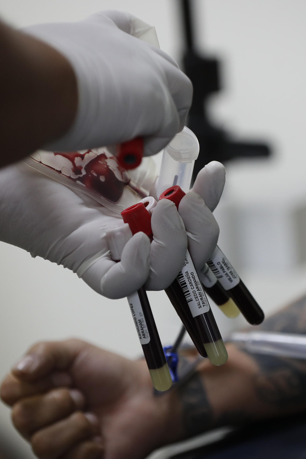 Fotografía de archivo del 13 de junio de 2022, donde se observa a una persona donando sangre, en un hospital en la Ciudad de México (México). EFE/ José Méndez