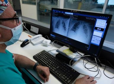 Día Mundial del Cáncer de Pulmón: Más de la mitad de pacientes con cáncer de pulmón ALK positivo sigue sin progresión a siete años