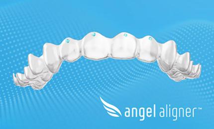 Angel Aligner renombra Torque Ridges como Pressure Points en Europa